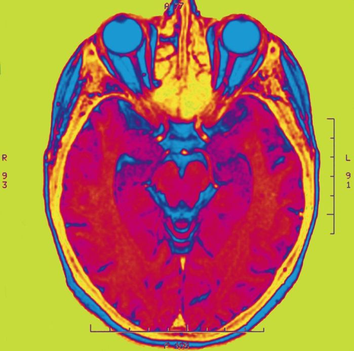 BSIP-UIG-Getty Images